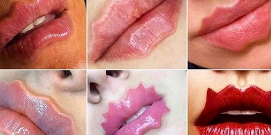 Nieuwe liptrend 'devil lips' is naast freaky ook nog vaak onomkeerbaar