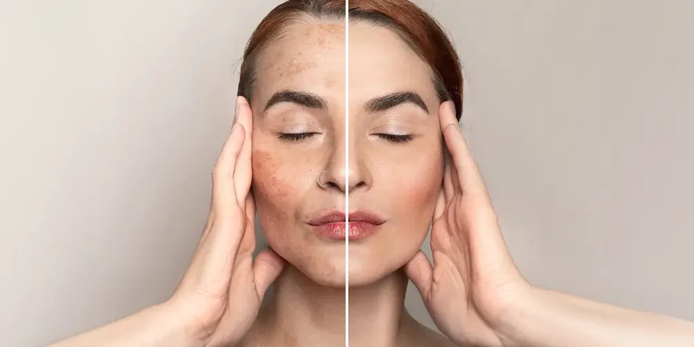 GHK-Cu: dé koperpeptide waar beauty influencers gek op zijn
